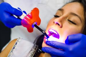 Zoom Teeth Whitening in Laguna Niguel