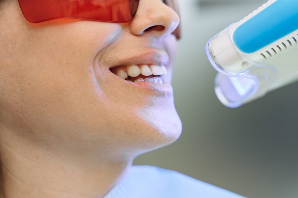 Zoom Teeth Whitening in Laguna Niguel