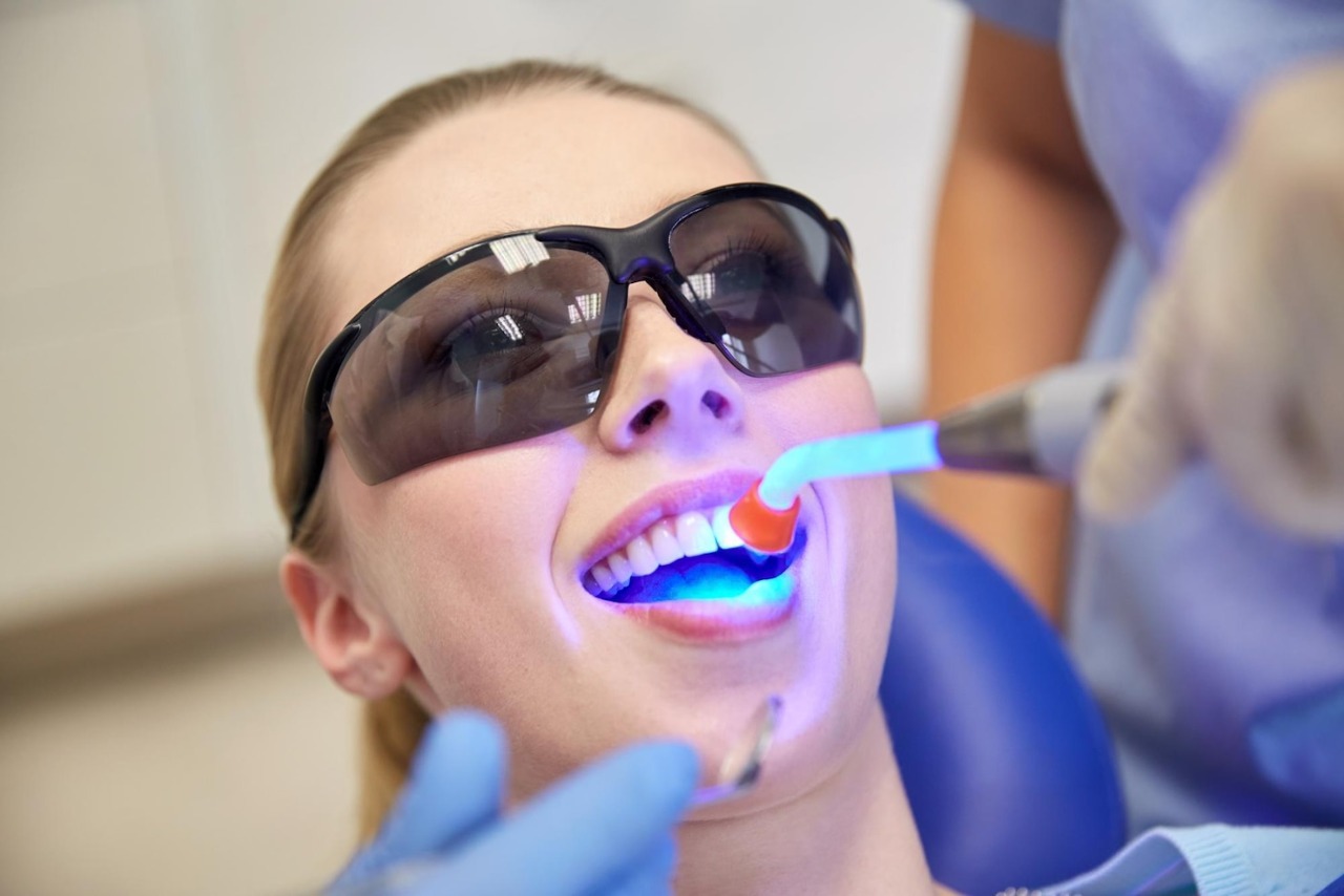Teeth Whitening Laguna Niguel